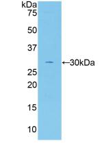 Polyclonal Antibody to Coagulation Factor V (F5)