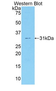 Polyclonal Antibody to Coagulation Factor V (F5)