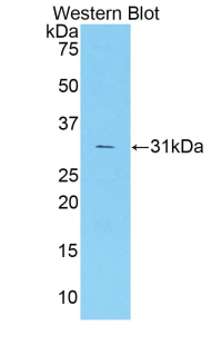 Polyclonal Antibody to Coagulation Factor V (F5)