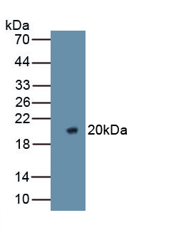 Polyclonal Antibody to Coagulation Factor V (F5)