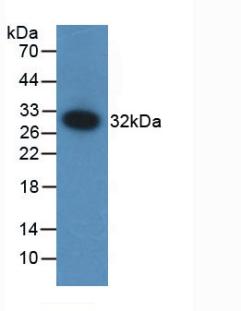 Polyclonal Antibody to Coagulation Factor XII (F12)