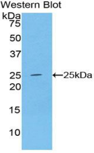 Polyclonal Antibody to Alcohol Dehydrogenase 1 (ADH1)