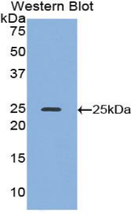 Polyclonal Antibody to Alcohol Dehydrogenase 1 (ADH1)