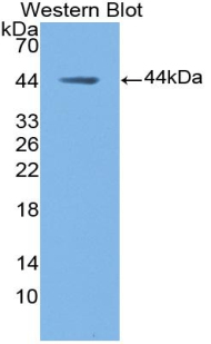 Polyclonal Antibody to Mucin 5 Subtype B (MUC5B)