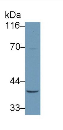 Polyclonal Antibody to Cluster Of Differentiation 14 (CD14)