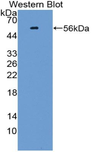 Polyclonal Antibody to TGF Beta Inducible Early Response Gene 1 (TIEG1)