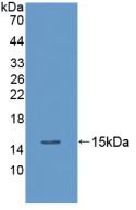 Polyclonal Antibody to Procalcitonin (PCT)