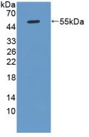 Polyclonal Antibody to Kallikrein 8 (KLK8)