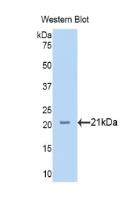 Polyclonal Antibody to Neuropilin 1 (NRP1)