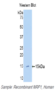 Polyclonal Antibody to Neuropilin 1 (NRP1)