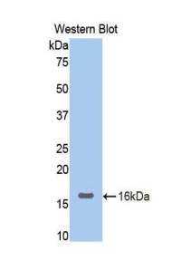 Polyclonal Antibody to Neuropilin 1 (NRP1)