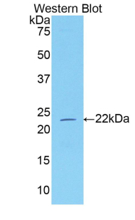 Polyclonal Antibody to Neuropilin 1 (NRP1)