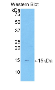 Polyclonal Antibody to Neuropilin 1 (NRP1)