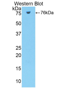 Polyclonal Antibody to Neuropilin 1 (NRP1)