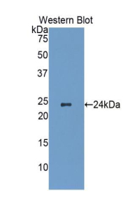 Polyclonal Antibody to Heat Shock Protein 27 (Hsp27)