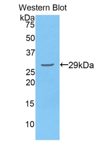 Polyclonal Antibody to Dihydrolipoyl Transacetylase (DLAT)