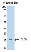 Polyclonal Antibody to Macrophage Migration Inhibitory Factor (MIF)