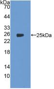 Polyclonal Antibody to Cyclooxygenase-2 (COX 2)