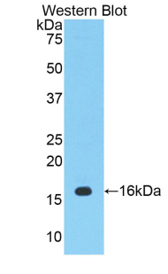 Polyclonal Antibody to Cyclooxygenase-2 (COX 2)