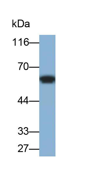 Polyclonal Antibody to Thioredoxin Reductase 1 (TXNRD1)