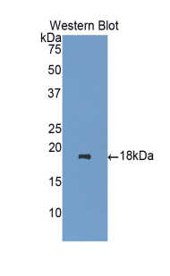 Polyclonal Antibody to Heparanase (HPSE)