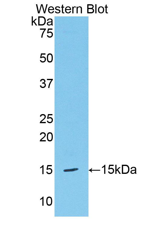 Polyclonal Antibody to Heparanase (HPSE)