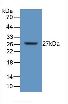 Polyclonal Antibody to Sodium/potassium Transporting ATPase Subunit Beta-3 (ATP1b3)