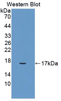 Polyclonal Antibody to Glucose-6-phosphate Dehydrogenase (G6PD)