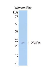 Polyclonal Antibody to Beta-Site APP Cleaving Enzyme 1 (bACE1)