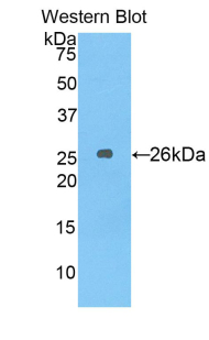 Polyclonal Antibody to Stromal Cell Derived Factor 4 (SDF4)