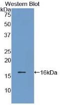 Polyclonal Antibody to Prealbumin (PALB)