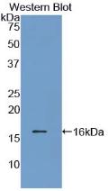 Polyclonal Antibody to Prealbumin (PALB)