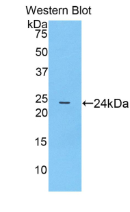 Polyclonal Antibody to Cyclooxygenase 1 (COX-1)