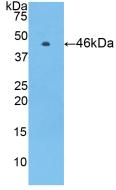 Polyclonal Antibody to Protein C (PROC)