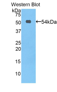 Polyclonal Antibody to Protein C (PROC)