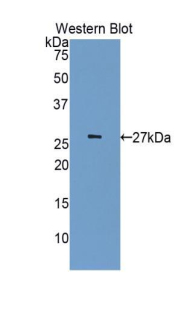 Polyclonal Antibody to Cyclin Dependent Kinase 5 (CDK5)