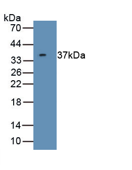 Polyclonal Antibody to Cyclin Dependent Kinase 5 (CDK5)