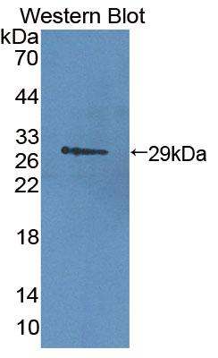 Polyclonal Antibody to Cluster Of Differentiation 38 (CD38)