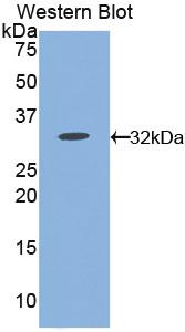 Polyclonal Antibody to Cluster Of Differentiation 38 (CD38)