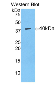 Polyclonal Antibody to Mucin 5 Subtype AC (MUC5AC)