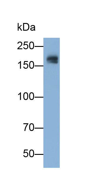 Polyclonal Antibody to Epidermal Growth Factor Receptor (EGFR)