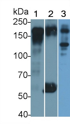 Polyclonal Antibody to Epidermal Growth Factor Receptor (EGFR)