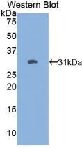 Polyclonal Antibody to Forkhead Box Protein O1 (FOXO1)