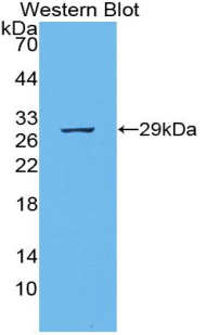 Polyclonal Antibody to Podocalyxin (PODXL)