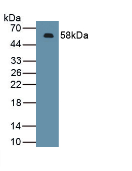 Polyclonal Antibody to Chemokine C-X-C-Motif Ligand 16 (CXCL16)