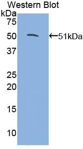 Polyclonal Antibody to Glucocorticoid Receptor Alpha (GRa)