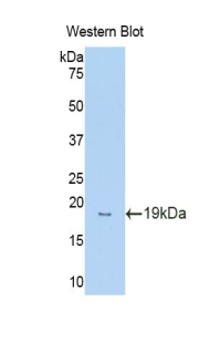 Polyclonal Antibody to Glucocorticoid Receptor Alpha (GRa)