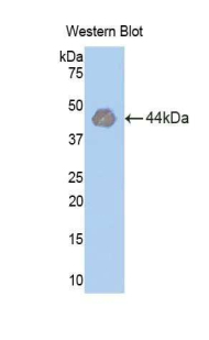 Polyclonal Antibody to Hexokinase 1 (HK1)