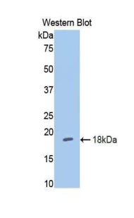 Polyclonal Antibody to Hexokinase 1 (HK1)