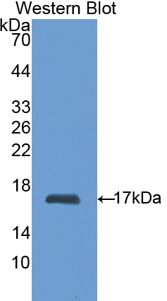 Polyclonal Antibody to Hexokinase 1 (HK1)